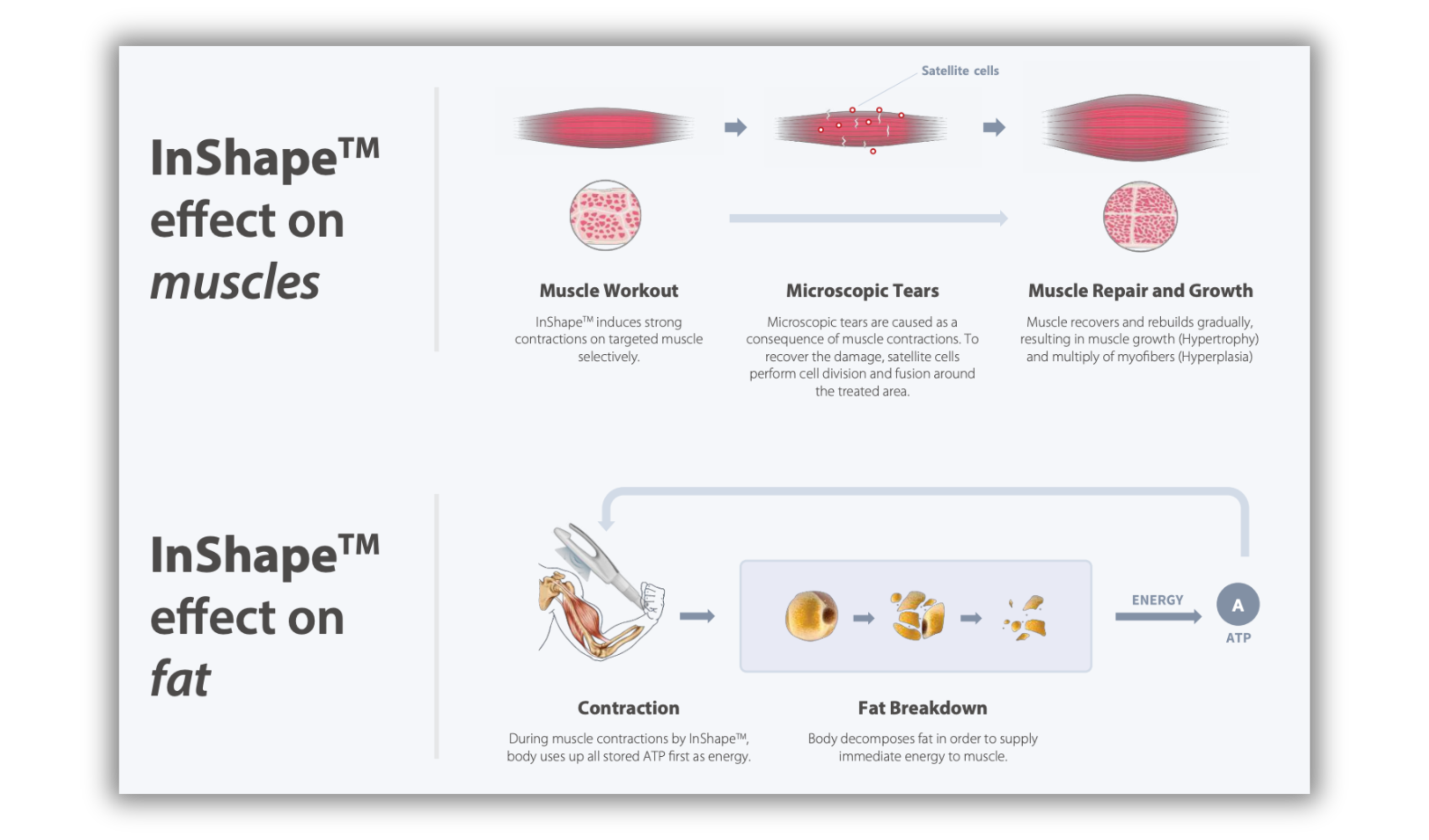 Inshape – Soma Lasers